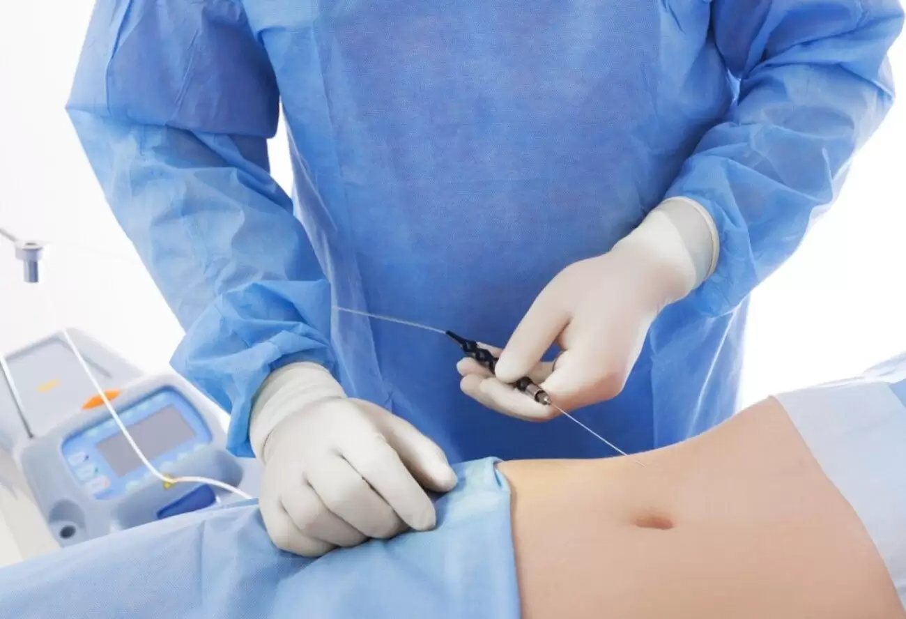 Liposuccion Precios Argentina cuanto sale 2025