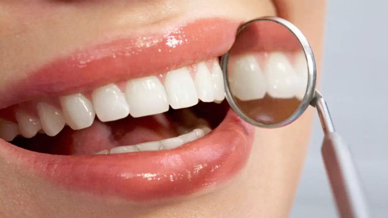 Cuanto cuesta implante dental en Argentina precios 2024