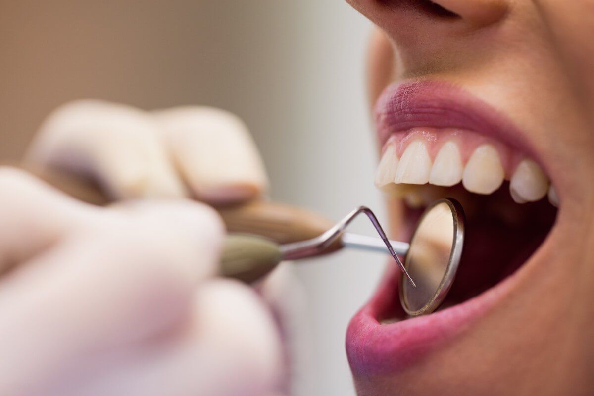 cuanto sale implante dental 2024
