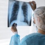 Aumentan un 65% los casos de tuberculosis en Argentina: la situación es alarmante