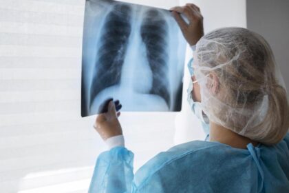 Aumentan un 65% los casos de tuberculosis en Argentina: la situación es alarmante