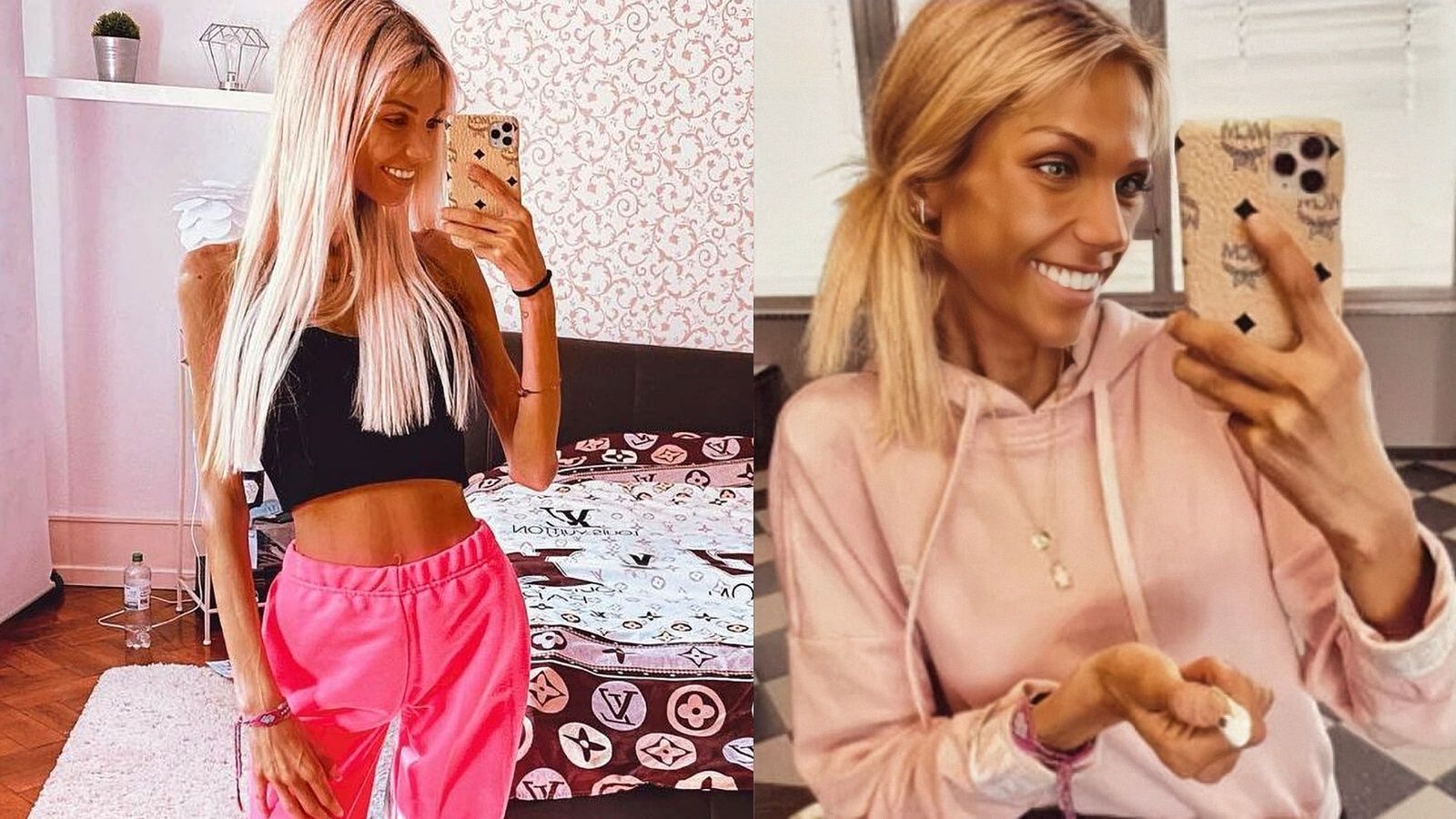 Josi Maria influencer anorexia