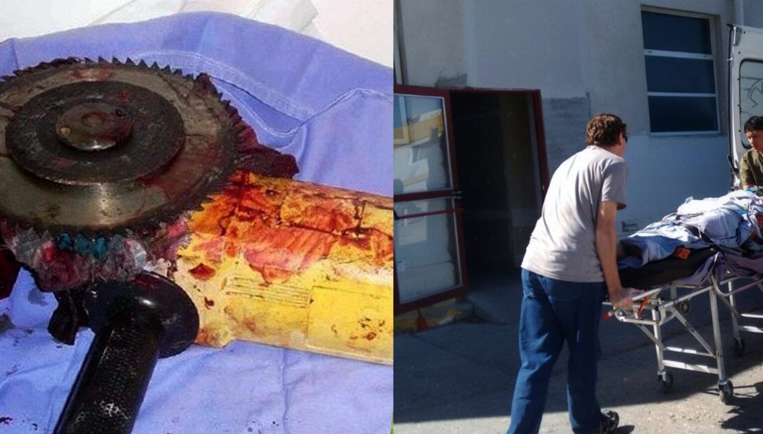 Hombre poda arbol amoladora