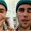 sindrome ramsay hunt justin bieber