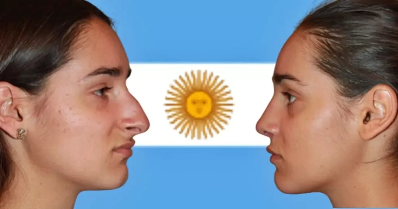 cuanto cuesta rinoplastia en argentina operacion de nariz precios 2024