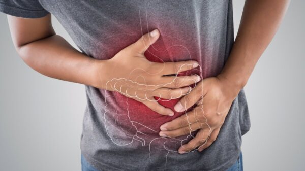gastritis-erosiva