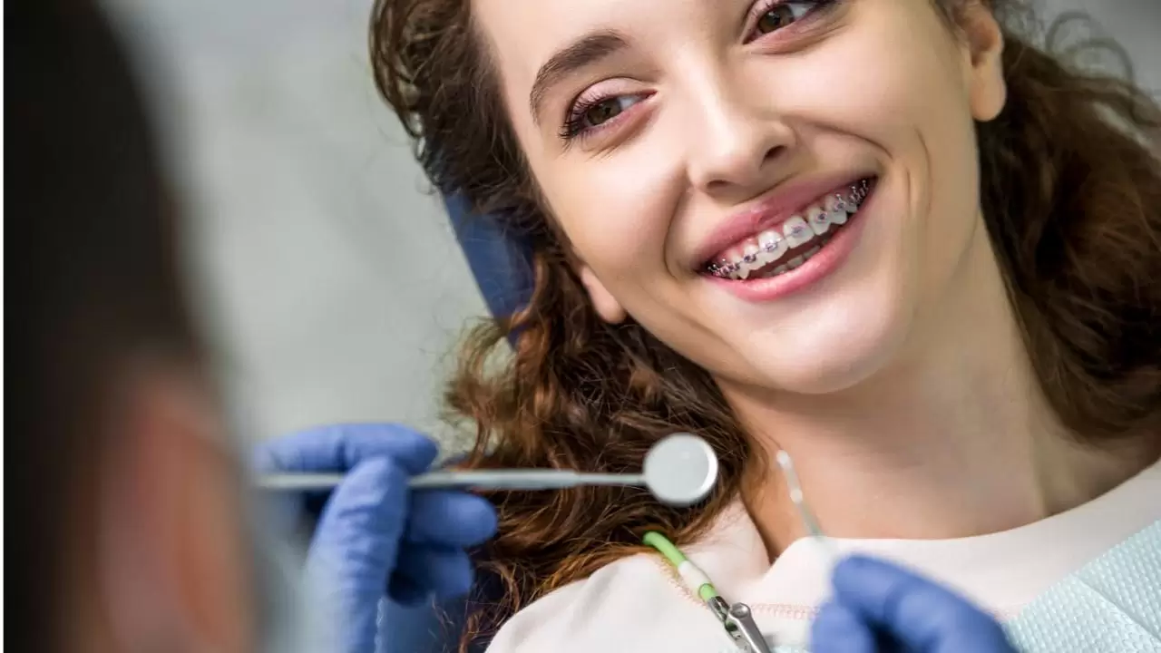 Cuánto cuesta ponerse brackets en Argentina Precios 2023