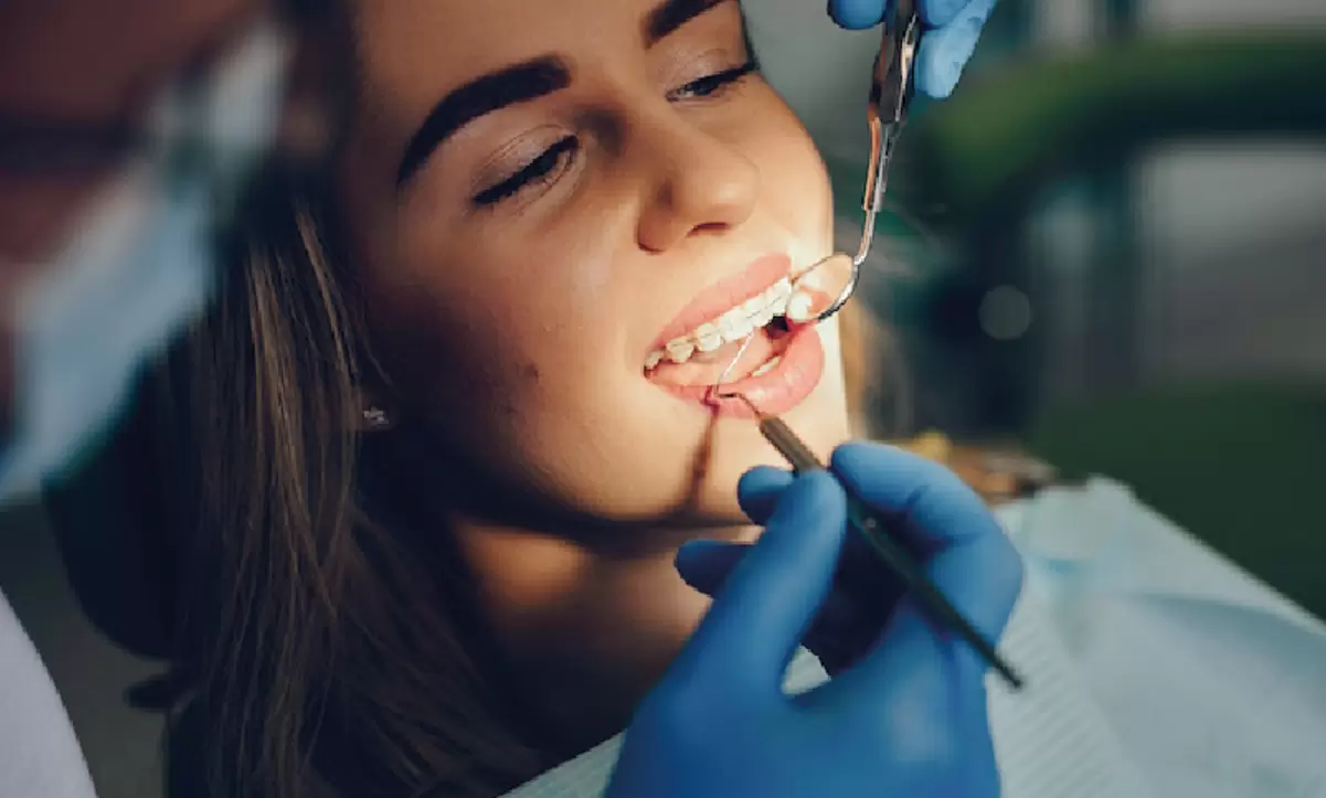 Cuanto cuestan los brackets en Argentina Precios 2024