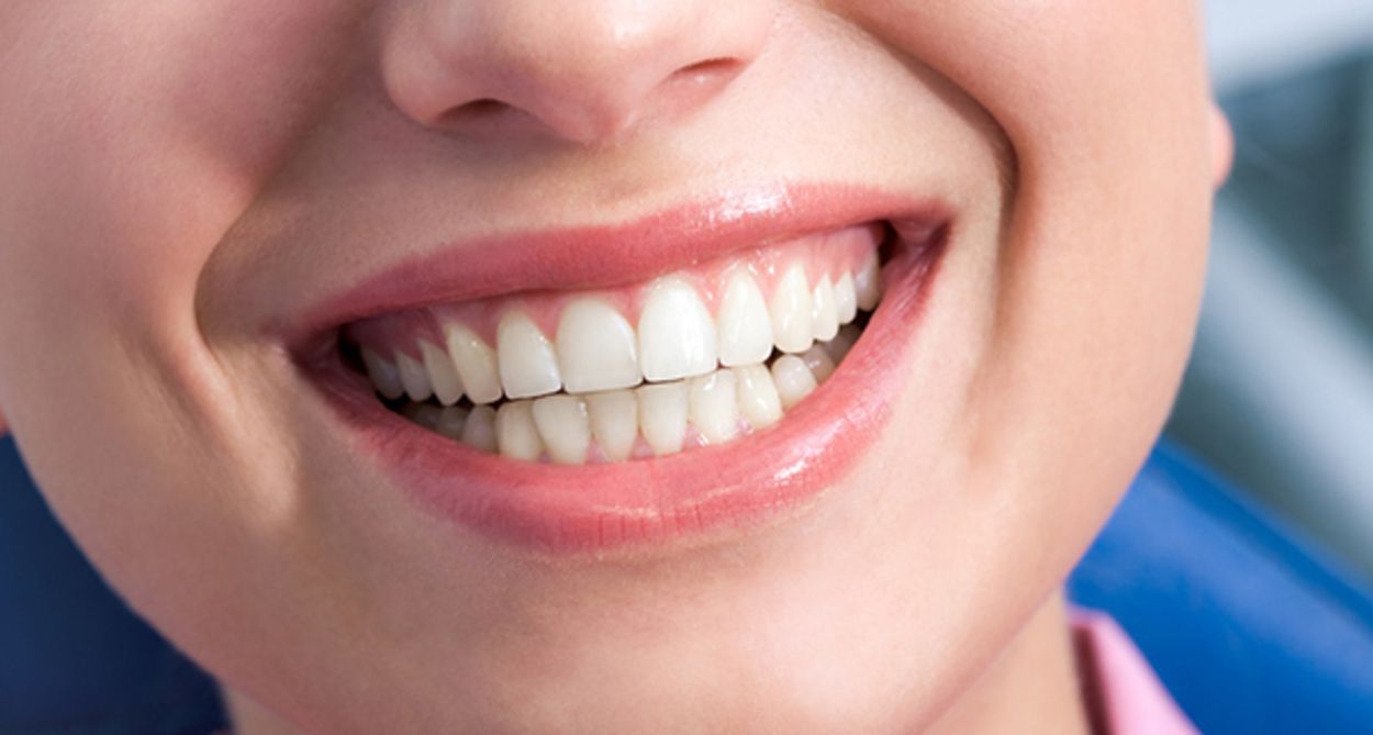implante-dental-costos-argentina