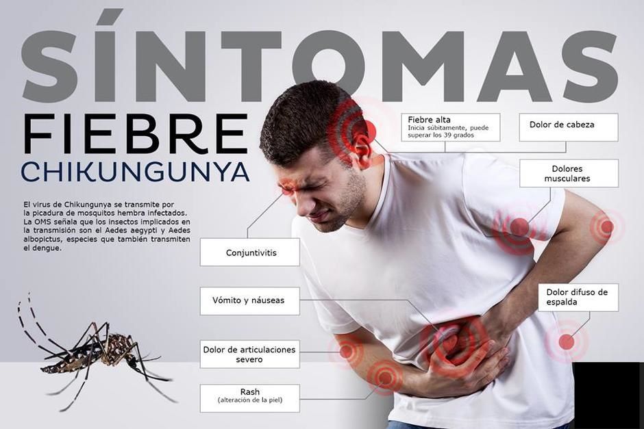 Provincia: Alerta por probable brote de Chikungunya ¿Qué es y cuáles son  los síntomas?