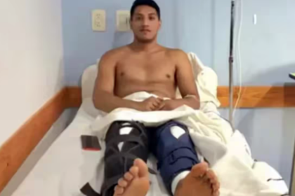 Fue a operarse la rodilla izquierda, pero se confundieron e intervinieron ambas piernas