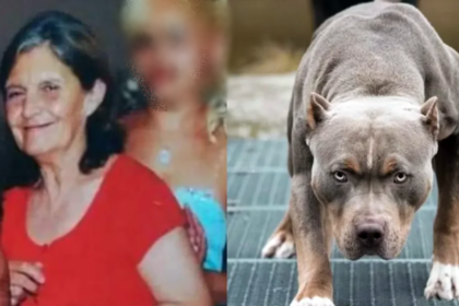 Dolor: murió la mujer que fue atacada por 5 perros pitbulls hace 2 meses
