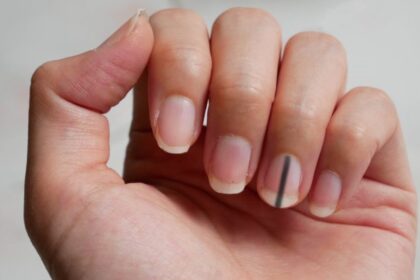 forma de uñas señales