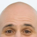 Dia del pelado
