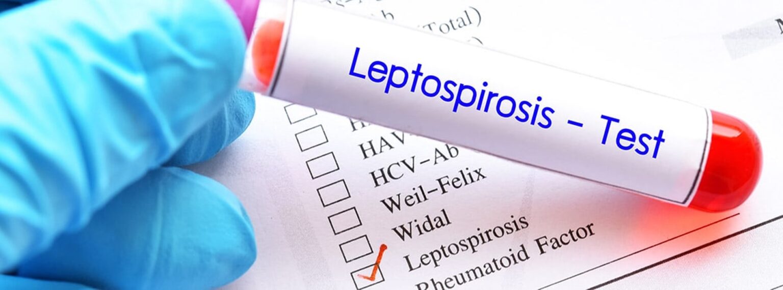 Leptospirosis