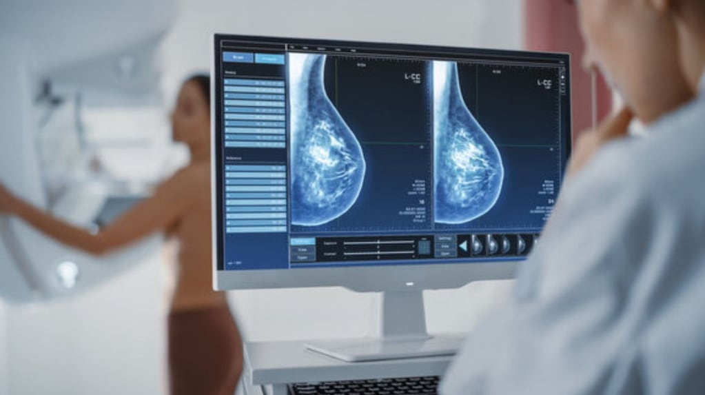 Cáncer de mama: la provincia de Buenos Aires adelanta mamografías a los 40 años para salvar vidas
