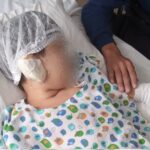 Un nene perdió parte de una de sus orejas tras ser atacado por un perro en Castelli