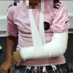 Conmoción en lobos: un hombre atacó a rebencazos a tres menores y a uno le fracturó un brazo