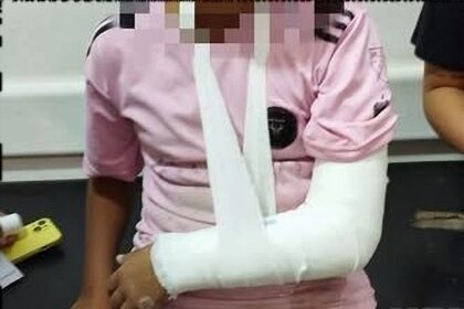 Conmoción en lobos: un hombre atacó a rebencazos a tres menores y a uno le fracturó un brazo